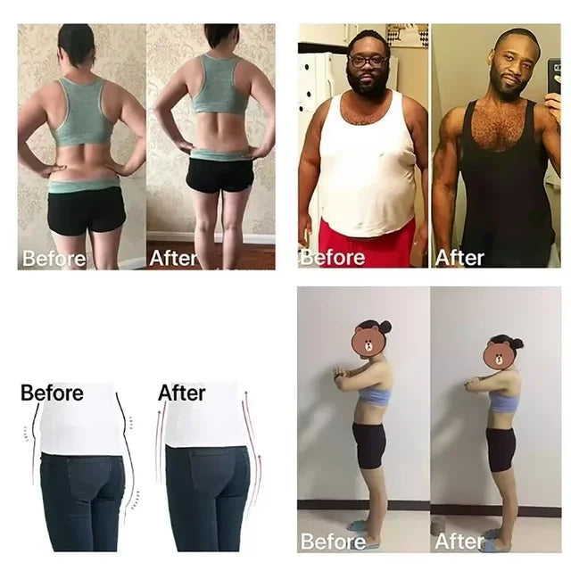 RelaxBelt - Cinto Terapêutico